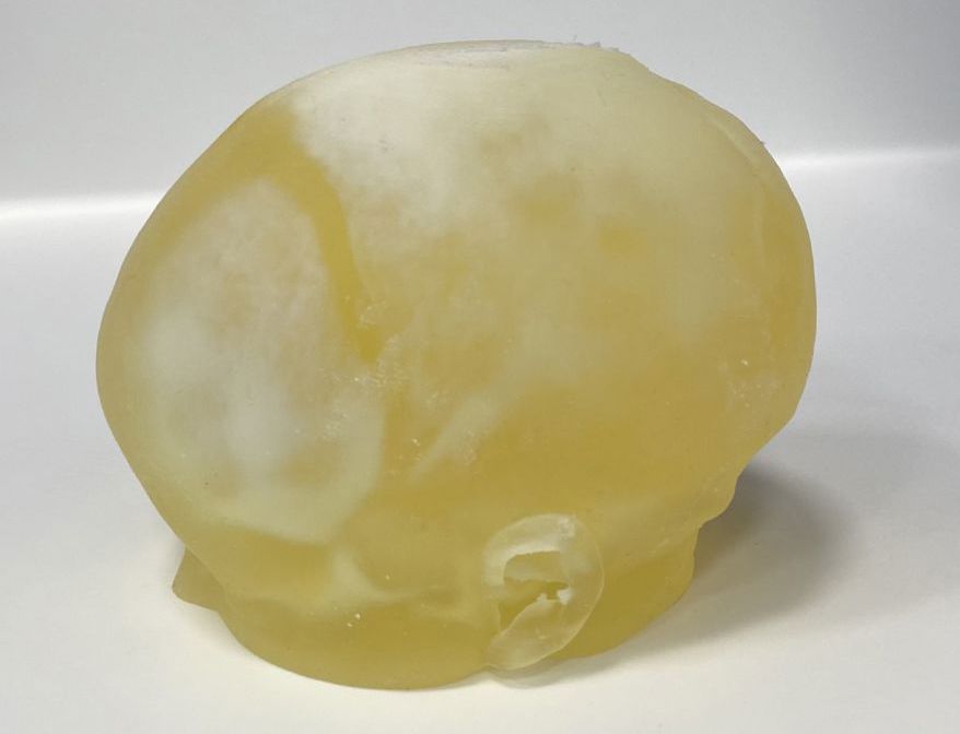 <div>Craniosynostosis Prototype Model created using Bone Matrix and <span style="letter-spacing: -0.03em;">Tissue Matrix Material - Side View.</span></div>