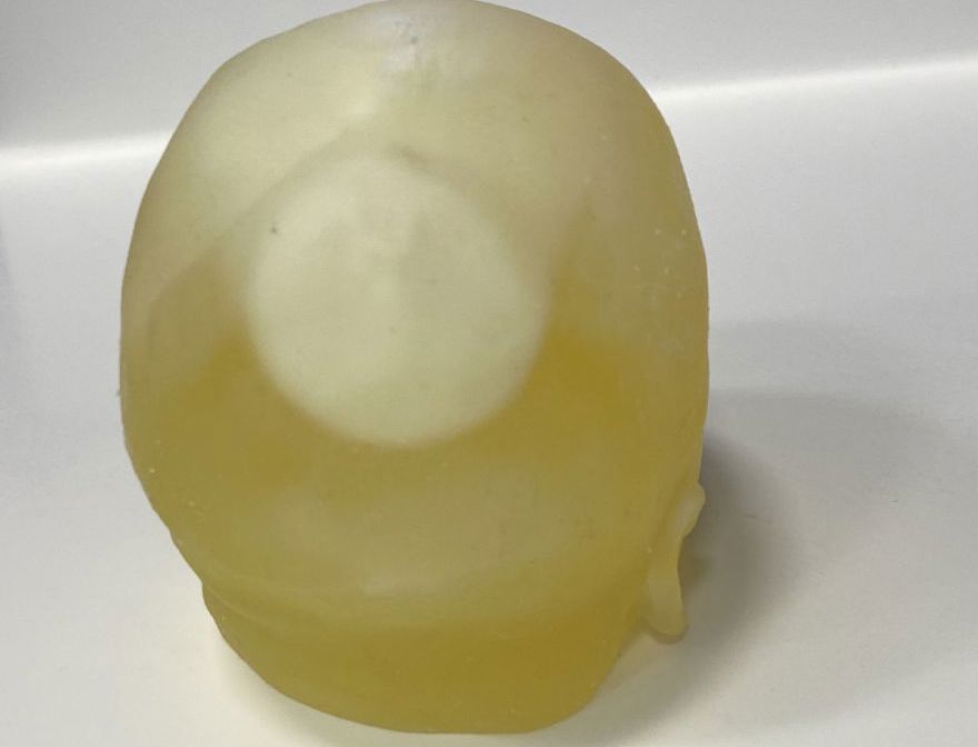 <div>Craniosynostosis Prototype Model created using Bone Matrix and <span style="letter-spacing: -0.03em;">Tissue Matrix Material - Rear/Overhead View.</span></div>