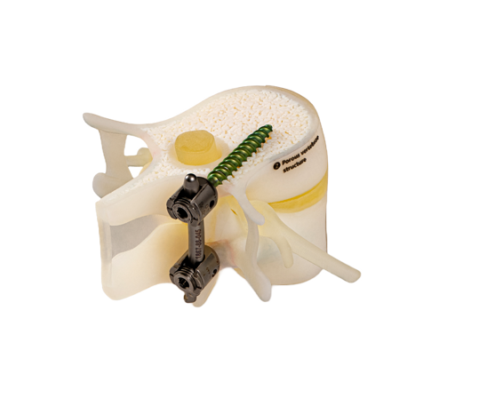 BoneMatrix