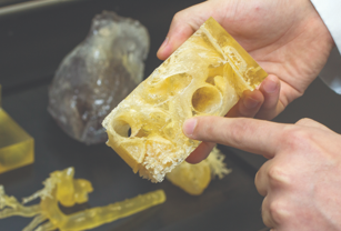 3D printed models are used to assess surgery risks to patients.