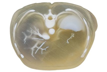 abdominal stack RadioMatrix Kit