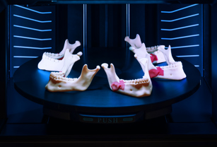 “A 3D print is worth a thousand pictures”:  J5 MediJet gives University Hospital of Southern Denmark, Esbjerg new pathway to improve pre-surgical planning and research