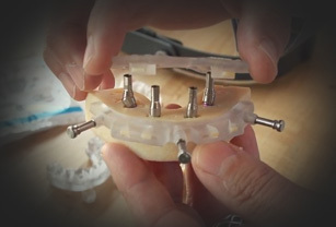 Implant Concierge Utilize