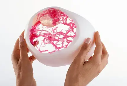 3d-printing-medical-model