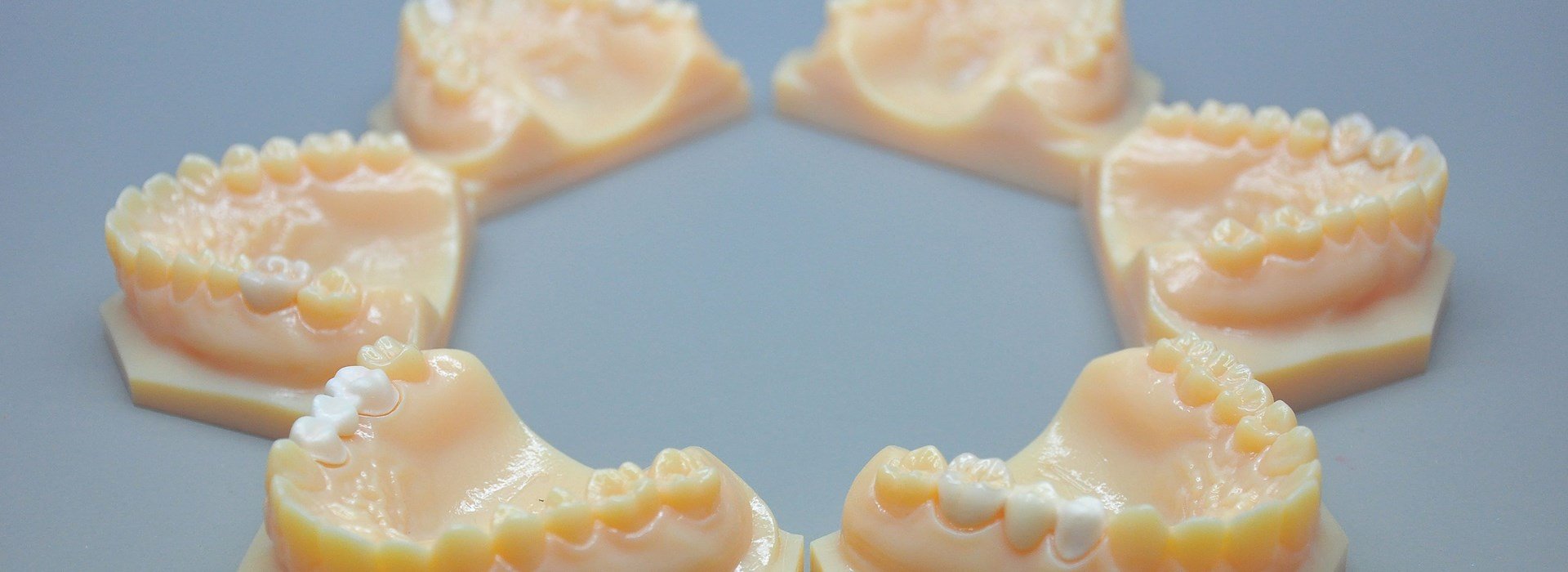 KTJ’s in-house 3D printer streamlined the customization of dental models, a crucial aspect of digital dentistry.