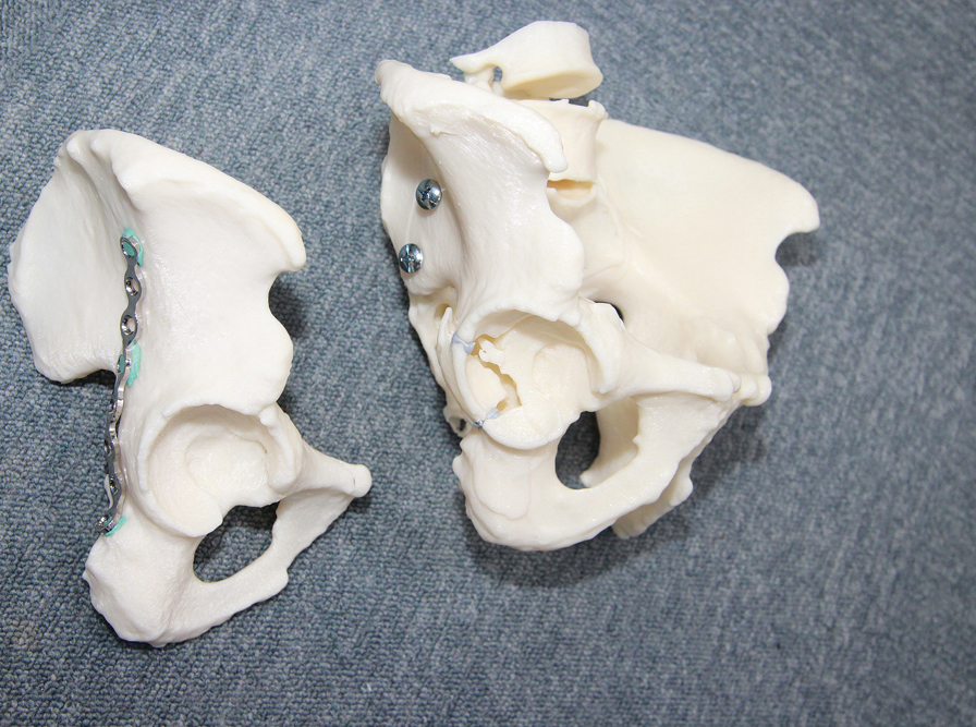 side view of 3d printed tailbone