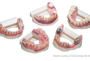 Dental models