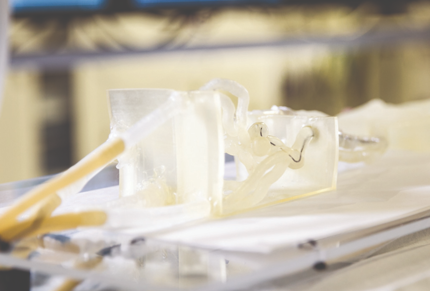 preoperative surgical planning