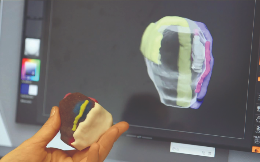 Wake 3D prints full-color models of kidney and prostate tumors based on patient-specific anatomy and pathology.