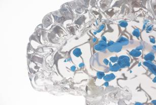 Stratasys Sagittal Blue