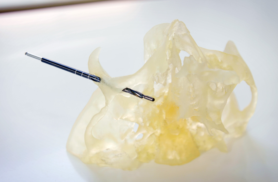 The team at Dawood and Tanner created a patient-specific 3D printed
model of a patient’s fibular to plan for a mandible reconstruction.&nbsp;