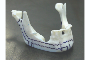 For facial and jaw reconstruction, 3D printed surgical models save three to four hours in the OR.