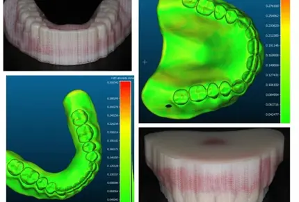 dental-model-scan.