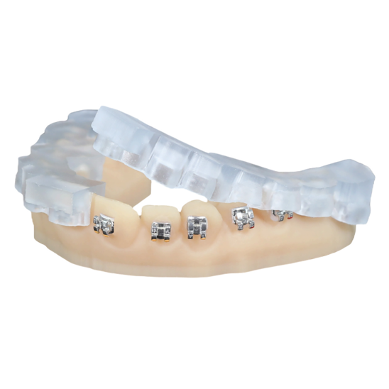 KeyOrtho-IBT origin one dental