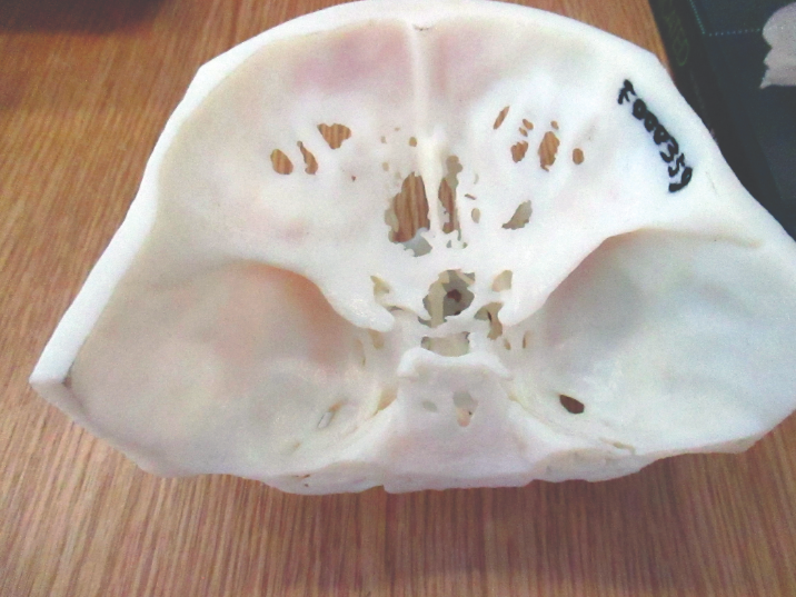 Interior view of the 3D facial model