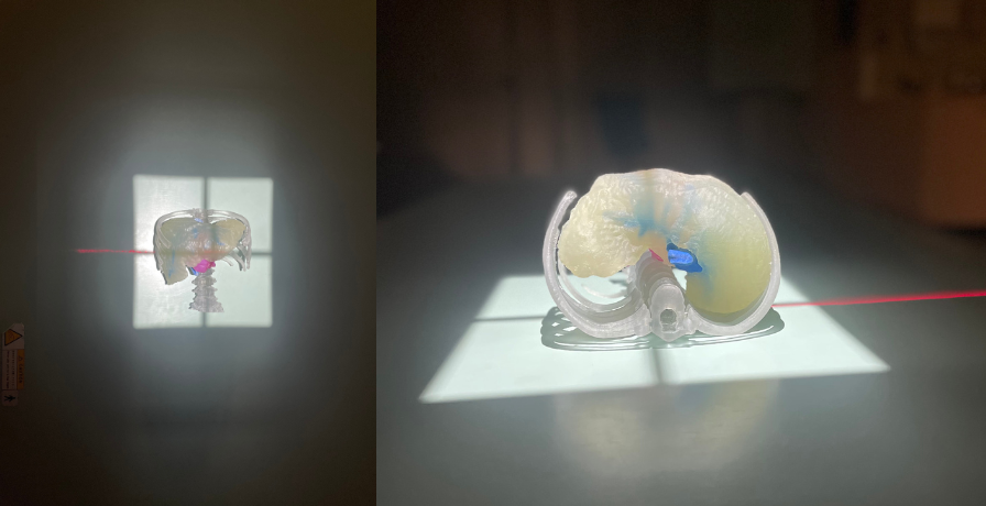3D Print liver model in xray