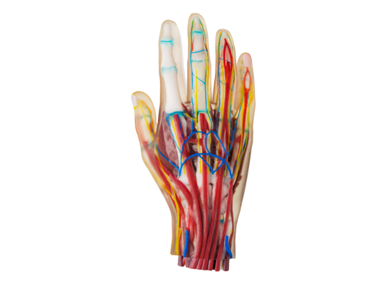 3D printed medical model hand by Stratasys Polyjet technology