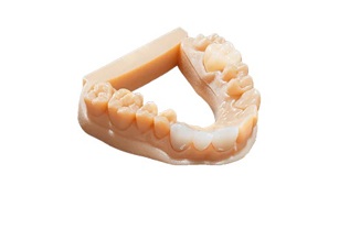 PS Dentallabor Linz Takes Customized Dental Appliances to the Next Level with Ultra-Realistic J5 DentaJet 3D Printers.