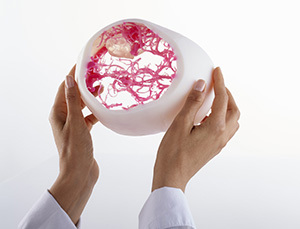 holding-3d-printed-medical-model.
