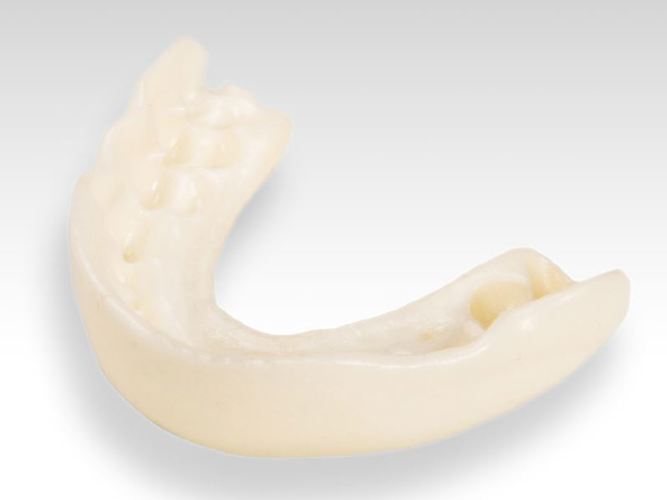 Addigy P3001 - 3D Printed Mouth Guard.