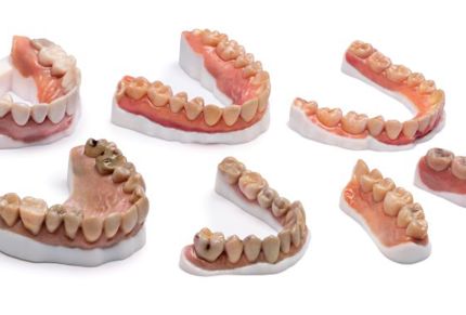 VeroVivid Color & Vero White Model Resins