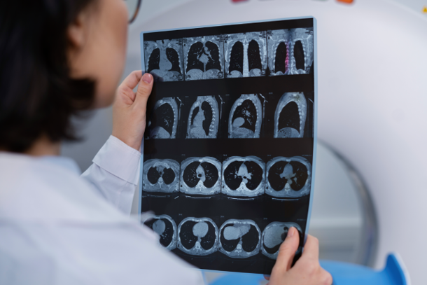 doctor-looking-ct-scan