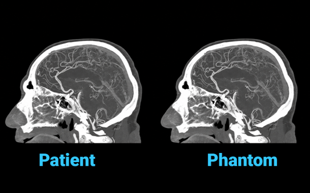 stratasys-comparison-patient-vs-phantom