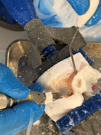 Post production of a 3D printed Stratasys PolyJet surgical model