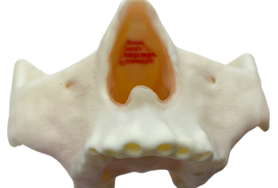 FuseTec used a Stratasys 3D printer to create a partial skull for dental training