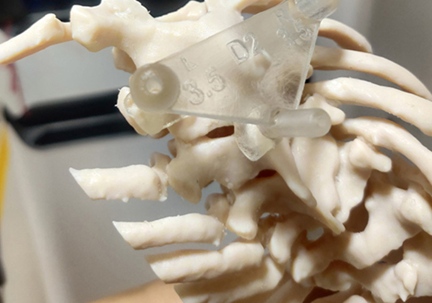 The Solution: Biocompatible 3D Printed Jigs