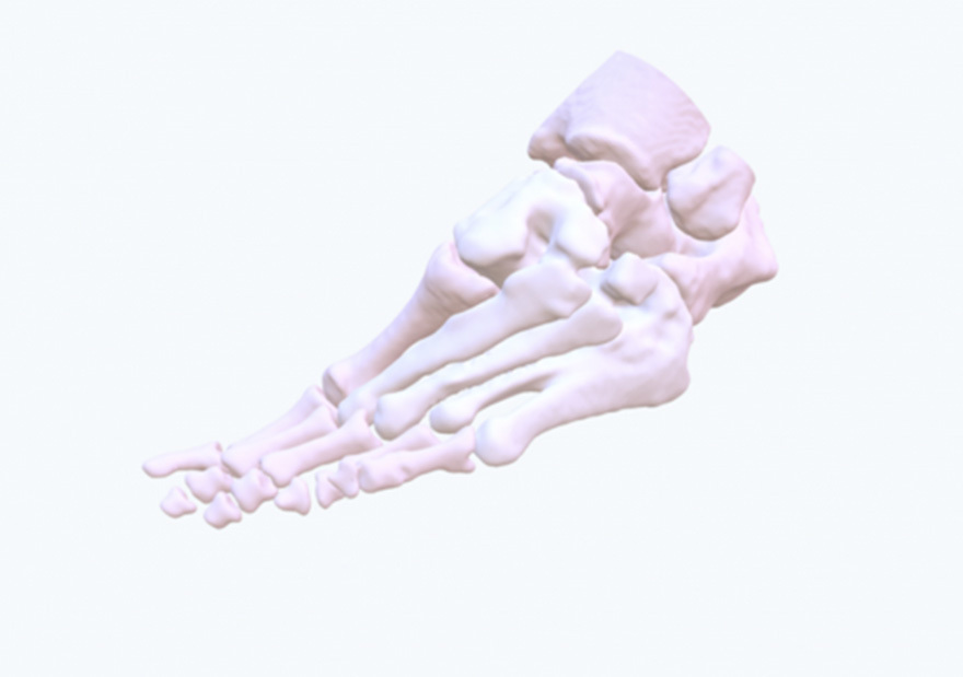 conceptualize the deformity on 2D images