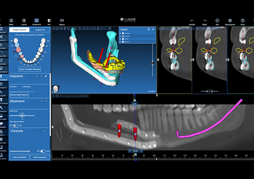 Stratasys PolyJet printing technology