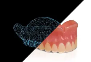 truedent-denture-with-print-matrix